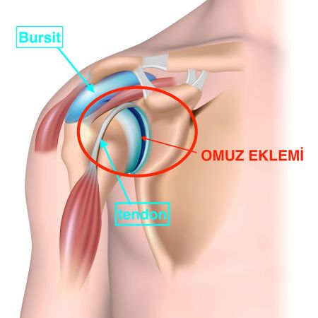 Omuz ağrıları nedenleri ve tedavisi! 10