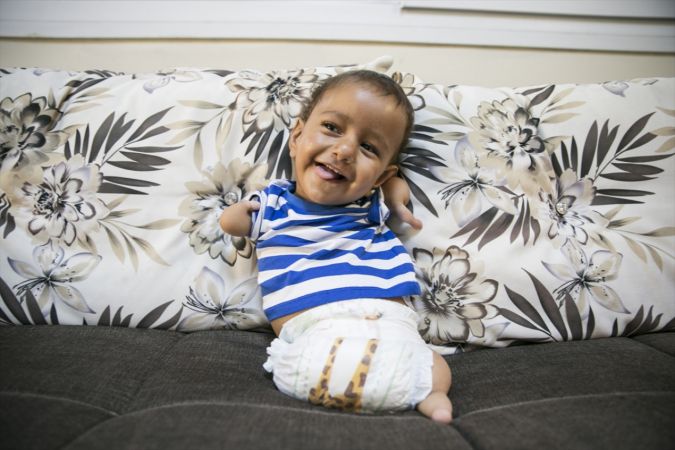 İdlibli 14 aylık Muhammed bebek, tetkikler için hastaneye götürüldü 2
