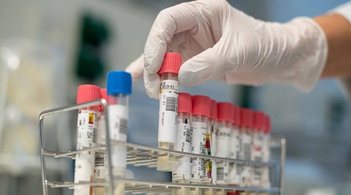 Ankara'da Hangi Hastanelerde Koronavirüs Testi Yapılıyor? 1