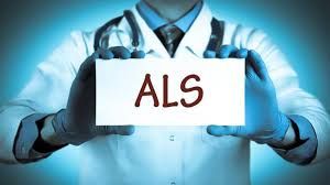 Suna Kıraç'ın Hastalığı ALS Nedir, Belirtileri Nelerdir, Neden Olur? 2