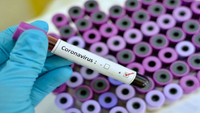 Koronavirüste son durum! Dünya genelinde vaka sayısı ve can kaybı kaç oldu? 3