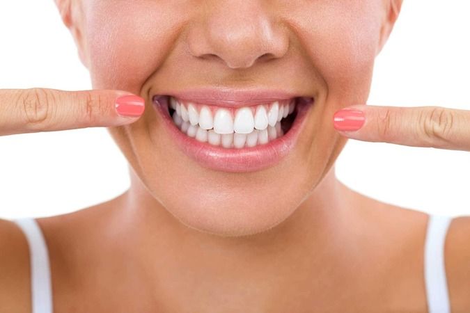 Devlet Hastaneleri Diş Teli Takar Mı? 2020 Devlette Diş Teli Tedavisi Fiyatları 1