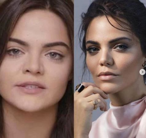 Bir Zamanlar Çukurova Dizisinin En Güzel Oyuncusunun Estetiksiz Halini Görenler Gözlerine İnanamıyor! "Bu Neymiş Böyle..." 4