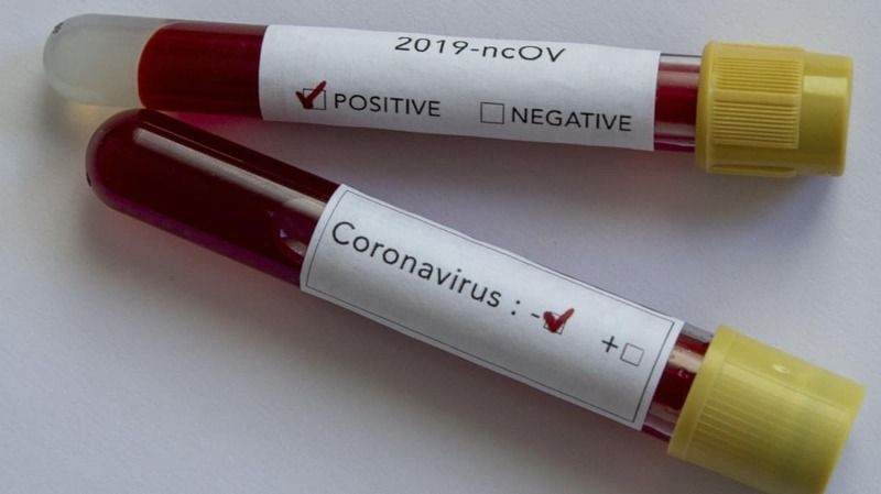 Koronavirüste son durum! Dünya genelinde vaka sayısı ve can kaybı kaç oldu? 22 Ekim 2020 2