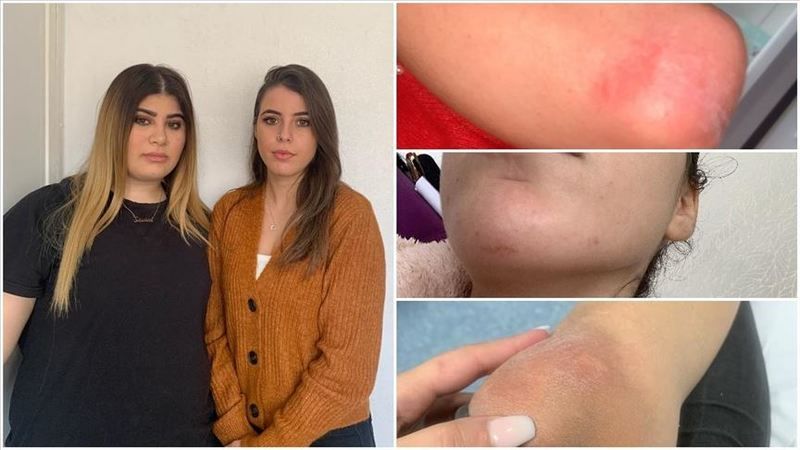 Fransa'da iki Türk genç kıza polis şiddeti 2