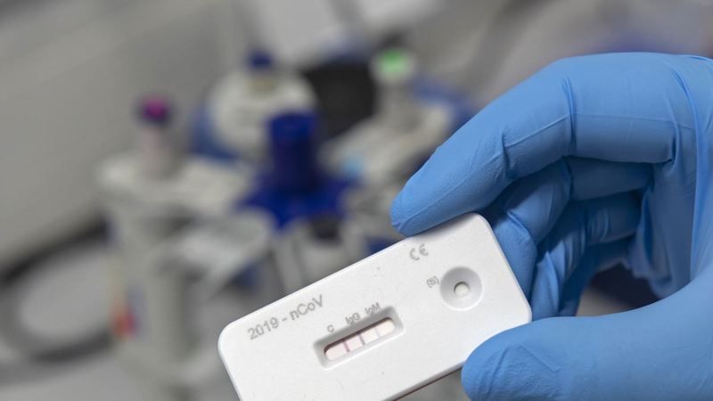 Antikor Testi Nedir, Nasıl Yapılır? Antikor Testi Kimlere Yapılıyor? 2