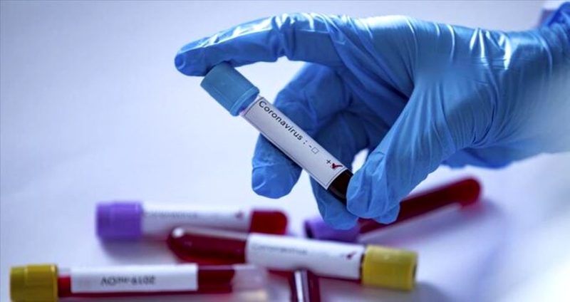 Antikor Testi Nedir, Nasıl Yapılır? Antikor Testi Kimlere Yapılıyor? 3