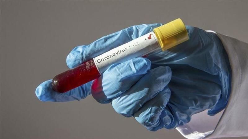 Koronavirüste son durum! Dünya genelinde vaka sayısı ve can kaybı kaç oldu? 7 Kasım 2020 2