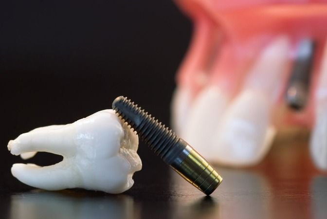 Diş Eksikliği Birçok Hastalığa Davetiye Çıkarıyor! 1