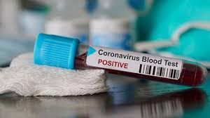 Koronavirüste son durum! Dünya genelinde vaka sayısı ve can kaybı kaç oldu? 24 Kasım 2020 1