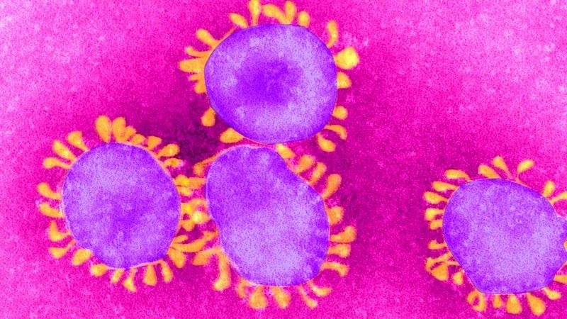 Koronavirüs Hastalığındaki Ölümlerin Nedeni Belli Oldu! Her Şey Çözüldü! Artık Ölümler Olmayacak… 1