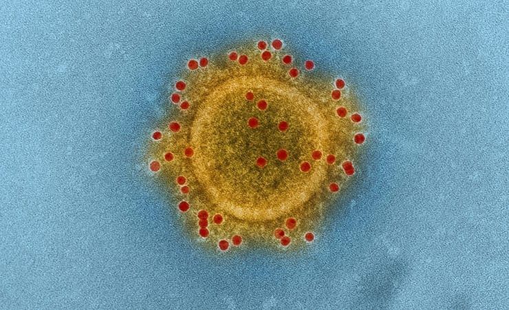 Korona Kadar Tehlikeli Adenovirüs uyarısı: Koronavirüs kadar hızlı yayılıyor! İşte belirtileri 2