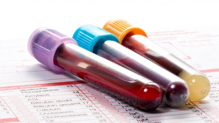 Koronavirüs Hastaları İçin Bir İlk! O Test Sayesinde Hastanın Durumu Daha Net Olacak! 3