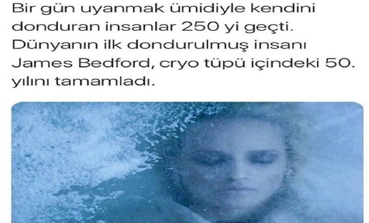 Tedavi Edilemez Böbrek Hastalığı Vardı! “Beni Siz Değil İleri Teknolojideki İnsanlar İyileştirecek!” Dedi, Donmayı Seçti! Herkes Ölü Olarak Biliyor Ama Ölü Değil! 1