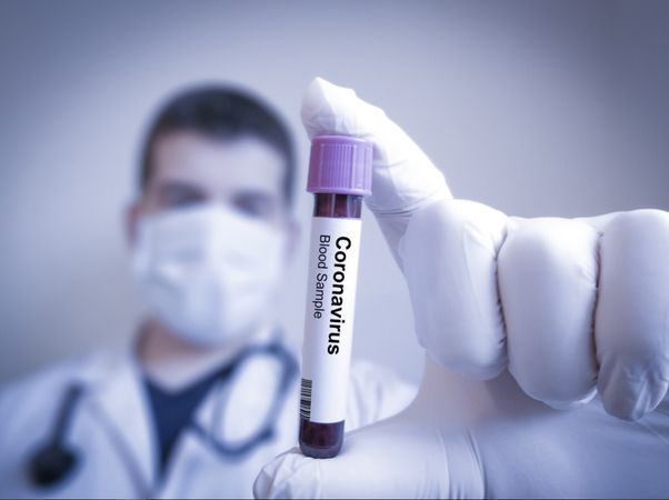 Ankara’da Kritik Süreç Başladı! Koronavirüs Vakalarında Önemli Bir Gelişme Yaşandı! Yasakların Kalkması An Meselesi… 3