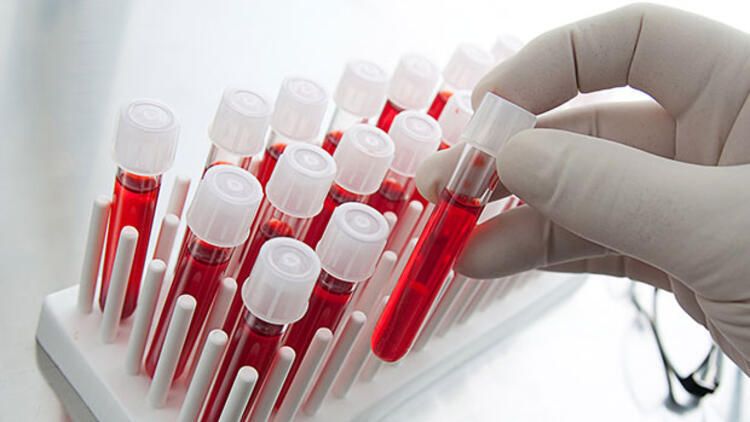 En zor Bulunan Kan Grubu Hangisidir? Türkiye'de En Çok Hangi Kan Bulunur? 1