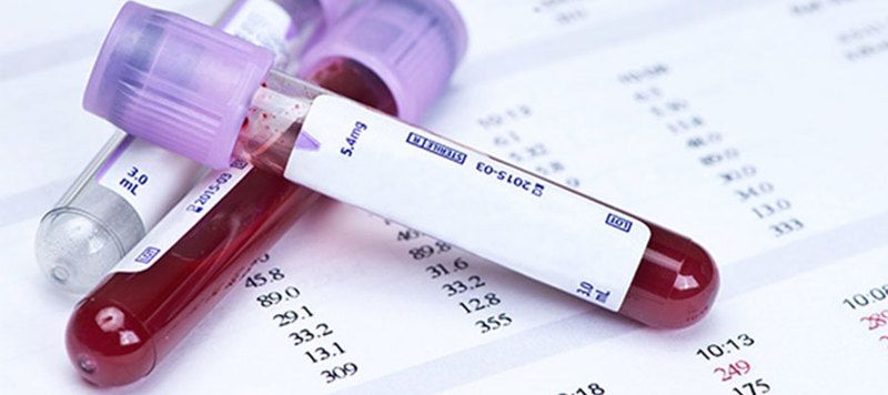Türk Bilim İnsanları, Gebelikte Kan Uyuşmazlığını 10 Dakikada Saptayan Test Kiti Geliştirerek Patentini Aldı! 1