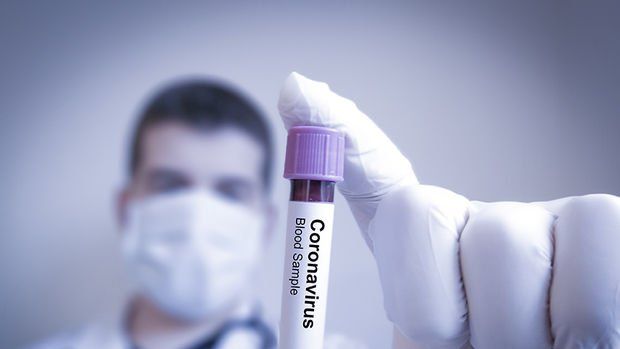 Ankara Koronavirüs Salgınında Sağlık Bakanı Koca Ne Yapılması Gerektiğini Açıkladı! Vaka Sayıları Bir Gecede Zirve Noktasını Gördü! Yasaklar Artırılacak Mı? 4
