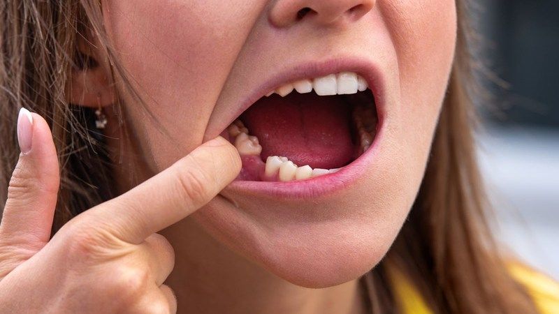 Diş Fırçalamayı Basite Almayın! Ağız Sağlığı Kötü Olanlar Kovid-19'u Şiddetli Geçiriyor! 1