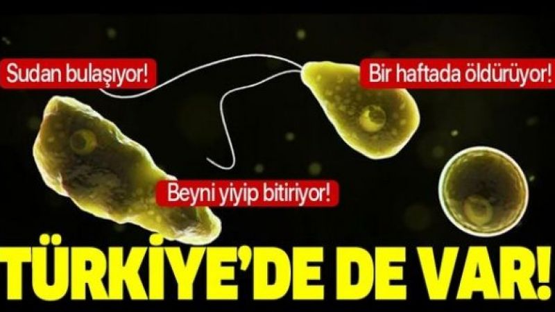Türkiye'de Görülmüştü! Dikkat, Beyin Yiyen Amiplerin Sayısı Artıyor! 1