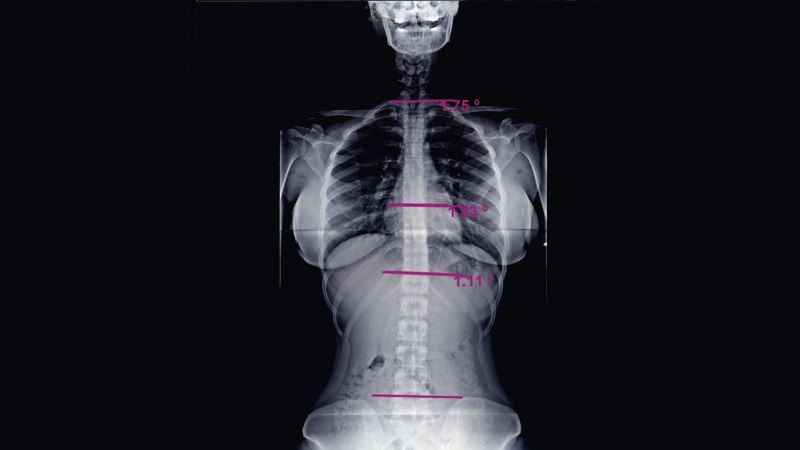 Röntgen Nedir Ne İse Yarar? Röntgen Neyi Gösterir? Röntgen Çekimi Nasıl Yapılır, Rötgeni Kim Bulmuştur? 2