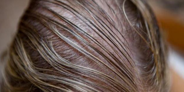 Yağlı Saçlar İçin Hangi Şampuan? Yağlı Saç Sorunu Nasıl Çözülür? 3