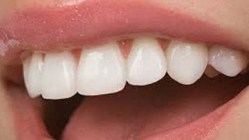 Dudakları Ve Dişleri En Güzel Görünen Burçlar Hangisidir? İşte Güzelliği Üzerine Çeken O Burçlar… 2