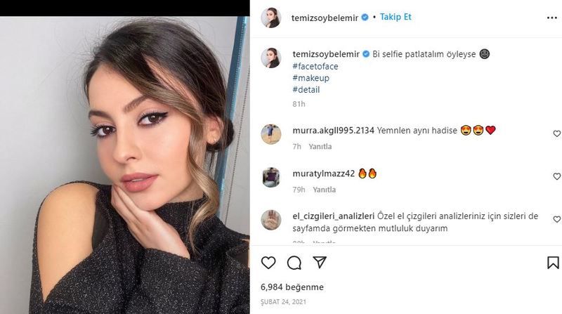 Hadise’ye Boşanma Sürecinde Kardeş Şoku! Görenler Gözlerine İnanamıyor... Resmen Kopyası! Yıllarca Bilememişiz, Ortaya Çıkınca Ortalık Karıştı! “Kız Hadise Ne Çektin Be Kıyamam!” 3