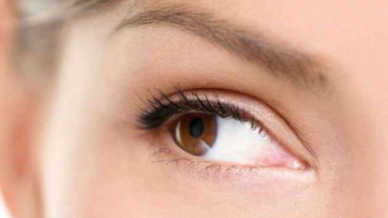 Göz Kapağı Estetiği Fiyatları Ortalama Ne Kadar? Göz kapağı ameliyatının riski var mı? Göz kapağı ameliyatı kaç günde iyileşir? 4