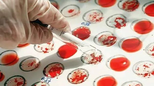 En Zeki Kan Grubu Belli Oldu! Japon Bilim İnsanları Açıkladı! Kan Grubunuz Karakterinizi Ortaya Koyuyor... O Kan Grubuna Dikkat! 2