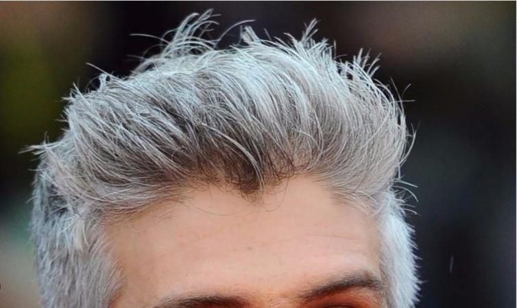 Beyaz Saçları Siyaha Çeviren Mucize Formül Bulundu! Beyaz Saçlar Saniyeler İçinde Kapanıyor! Doğal Saçlar Anında Kavuşun... 2