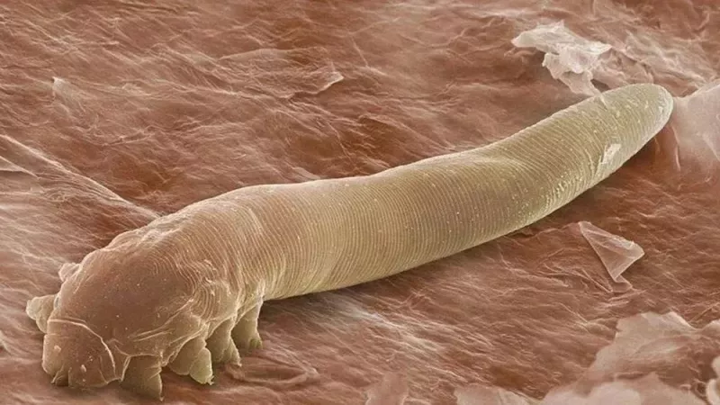 Yüzümüzde Bilmediğimiz Yüz Binlerce Canlı Yaşıyor: Temasla Bulaşıyor… Mikroskobik Boyutta Olan Bu Canlılar Korkuttu! 1