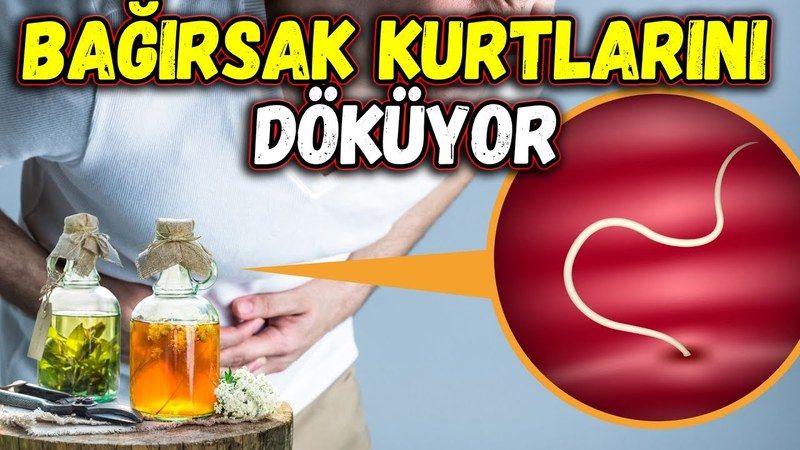 Vücudunuzda  Kurt, Solucan Varsa Uygulayın! Zencefil Yağı 20 Günde İyileştiriyor! Parazitlerin En Doğal Kurutma Yöntemi Buymuş... 1