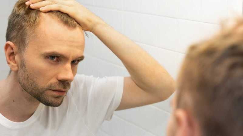 Saçı dökülen erkekler, bu formül sayesinde kel kalmaktan kurtuluyor: Mucizevi kür, saçlarınızı koruyor! 3