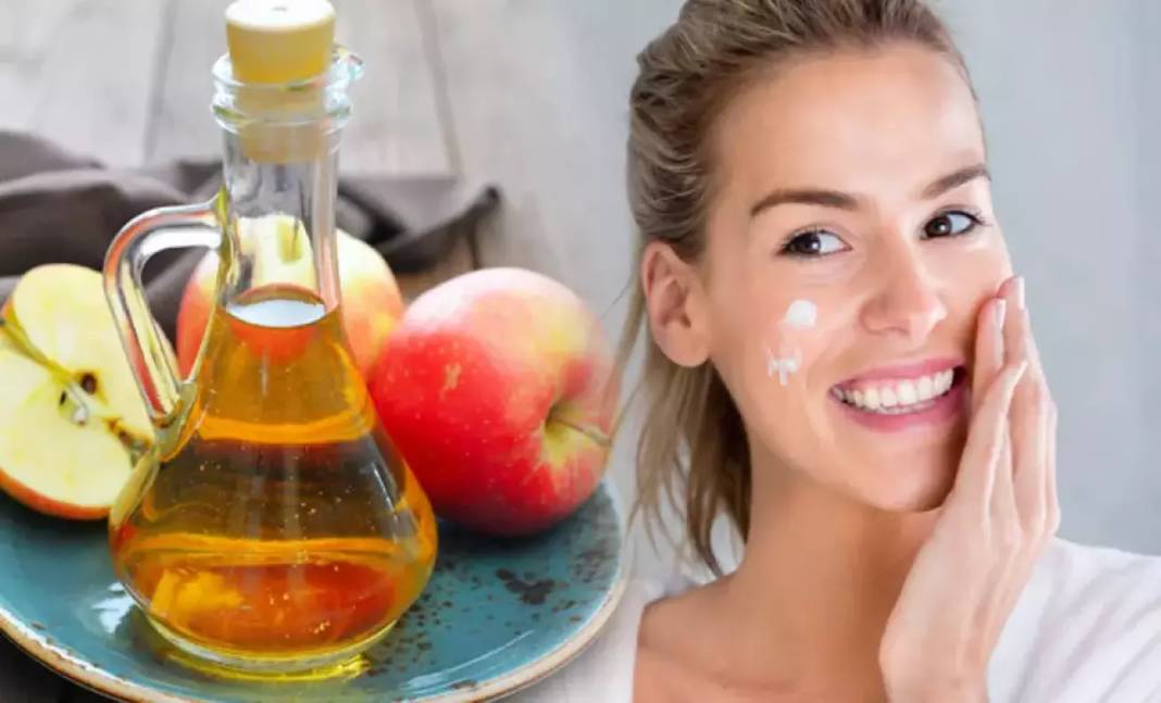 Saça, yüze, cilde her yere faydası var! Elma sirkesinin marifetlerini duyan yok artık diyor! Ama sakın bu hatayı yapmayın 1