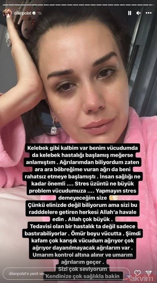 Dilan Polat’tan Kötü Haber! Dilan Polat Hasta mı, Hastalığı Nedir? Tedavisi Olmayan Lupus Hastalığı Nedir? 2