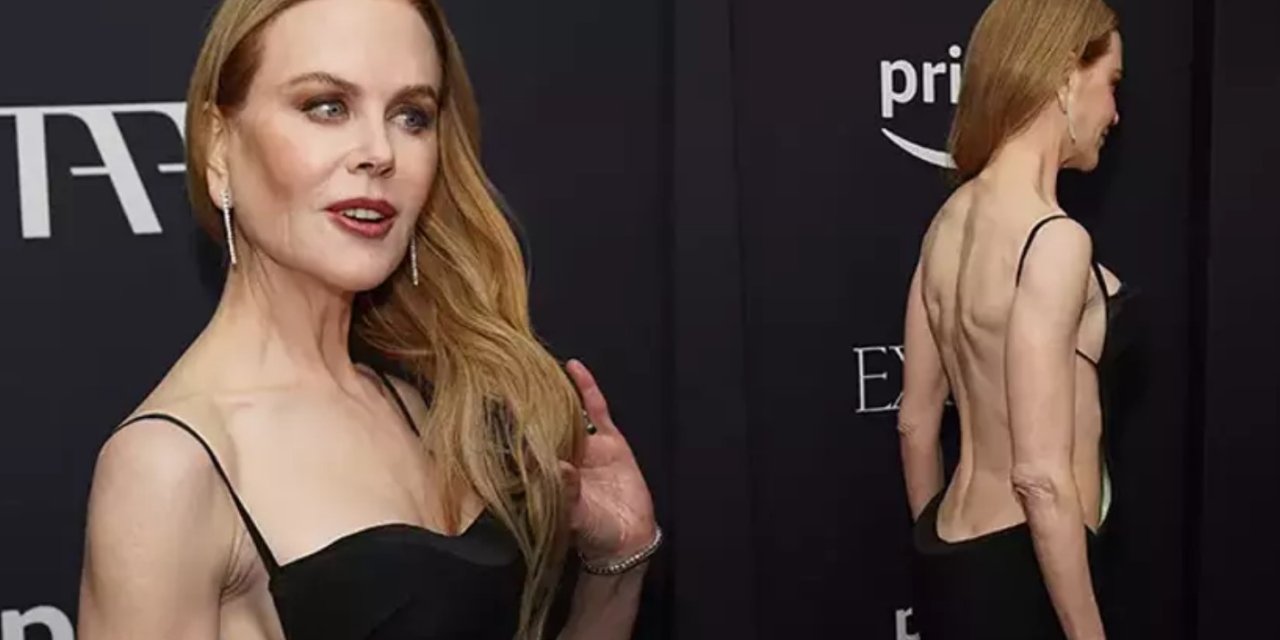 Ünlü Oyuncu Nicole Kidman'dan Sırt Ve Göğüs Dekolteli Elbise Şov! Galayı Yaktı Geçti Adeta!