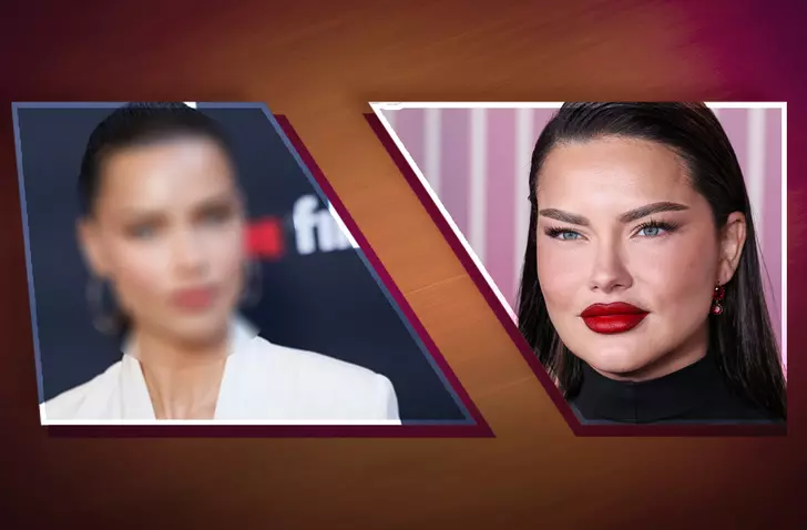 Adriana Lima'nın Son Hali Şoka Uğrattı! ''Estetiği Abartmış Biraz'' Yorumları Geldi!