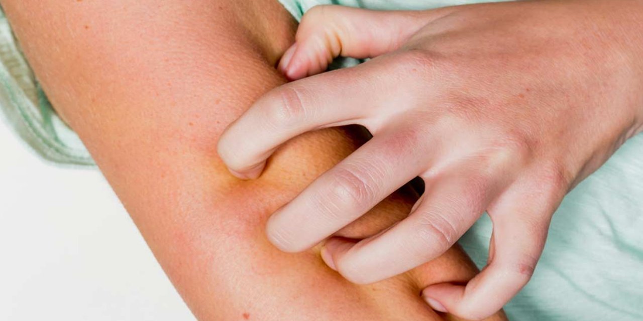 Kaşınıyorsanız Dikkat! Uzmanlar Kanser Belirtisi Diyor! ''Sindirim Sorunu Sanıyorduk Ama Daha Ciddi Çıkabilir!''