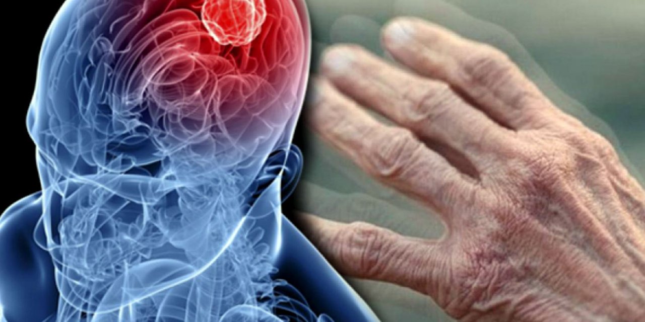 Bu Belirtiler Varsa Dikkat Edin! Parkinson Hastalığında Erken Tanı Hayat Kurtarıyor! Artık Gençlerde Bile Görülüyor!