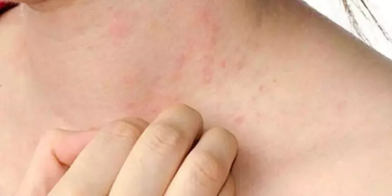 “Öğretmen Hastalığı” Efsanesi Gündemde! Bu Belirtiler Varsa Acilen Doktora Gidin! Uzmanlar Uyardı!