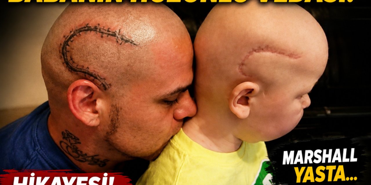 Ameliyat İzini Dövme Yaptıran Babanın Hüzünlü Vedası! Marshall  Yasta... Hikayesi!
