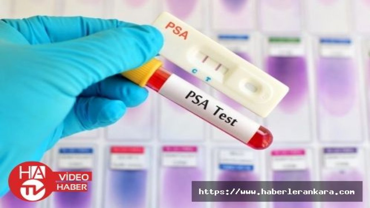 Prostat kanserinin tespiti için PSA testi önerisi