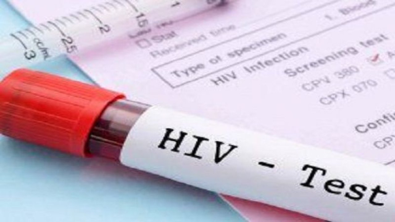 Çankaya Belediyesi HIV, AIDS danışmanlığı hizmeti vermeye başladı