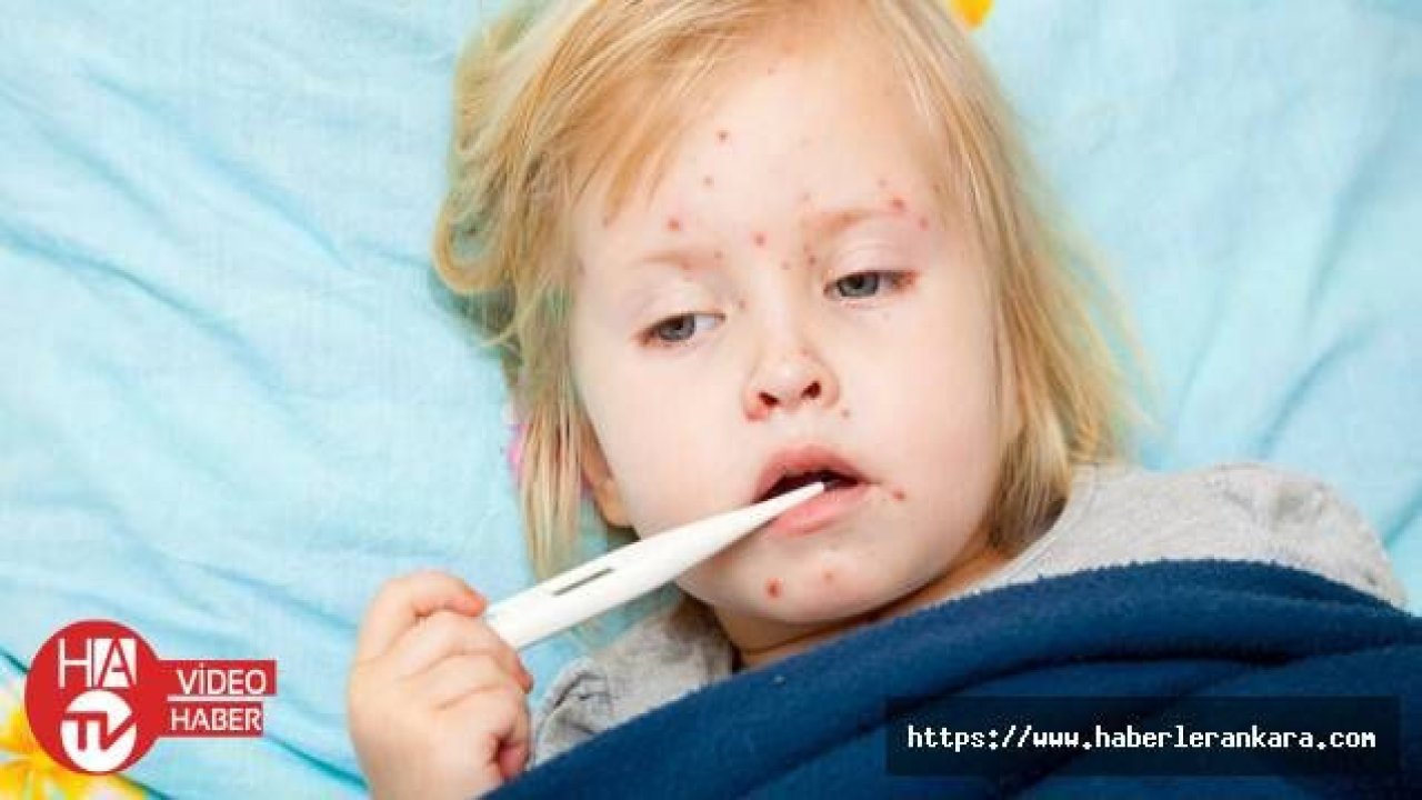 ABD'de kızamık salgını sona erdi