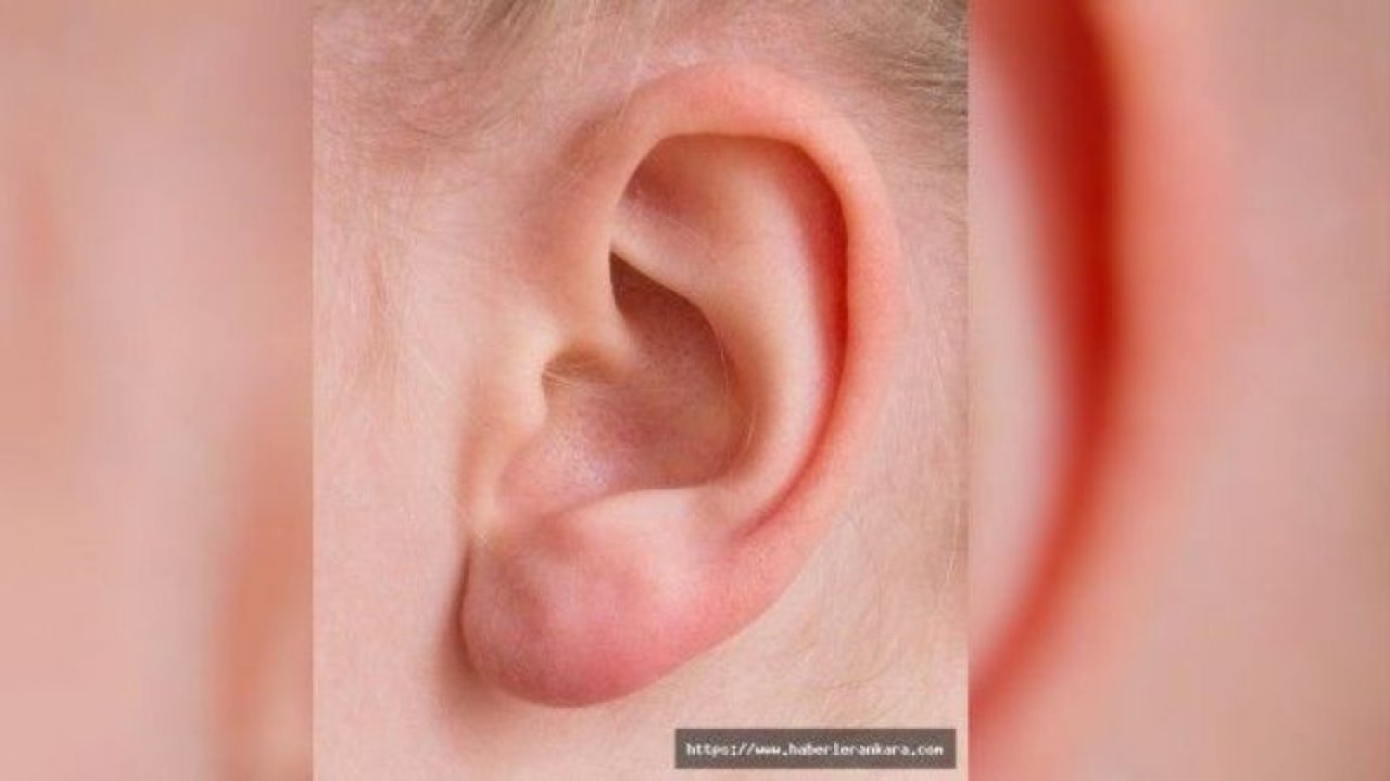 Kulaklarınıza Nelerin Zarar Verdiğini Biliyor Musunuz?