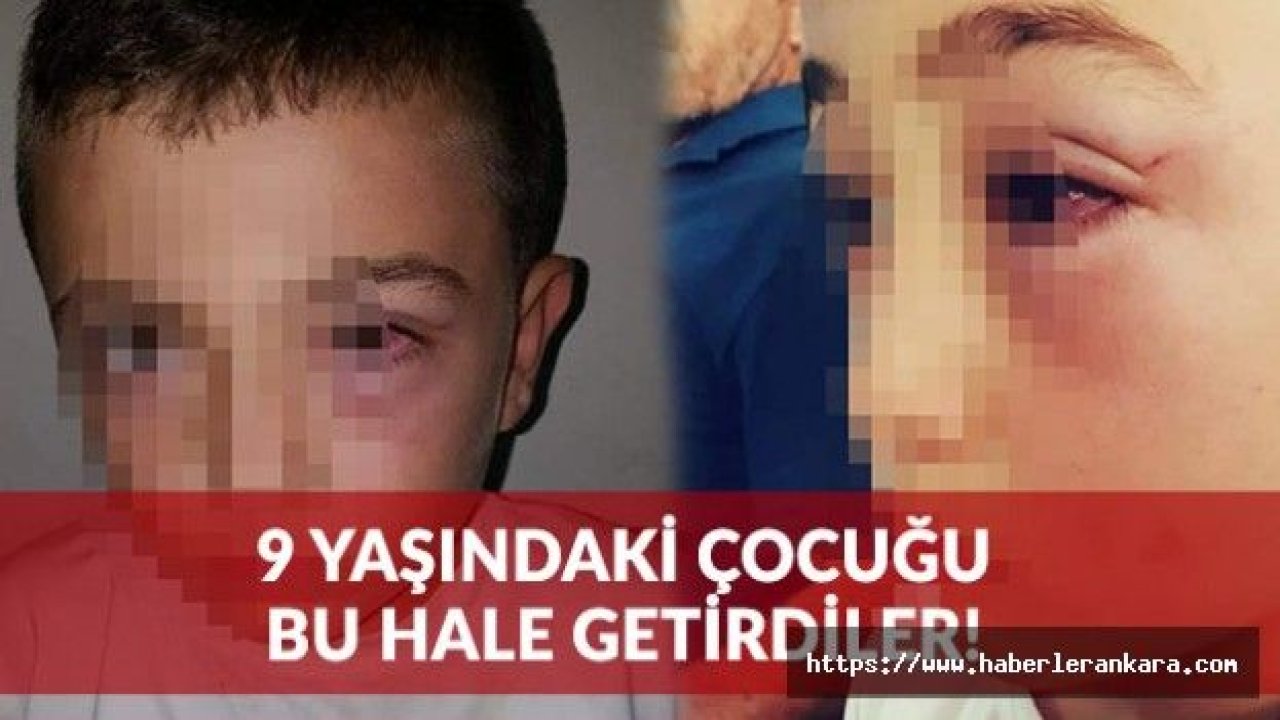 Cani Baba 9 Yaşındaki Çocuğu Bu Hale Getirdi!