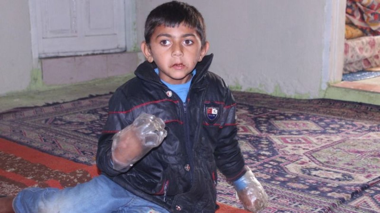 Ellerini ısıran çocuk, tedavi altına alındı