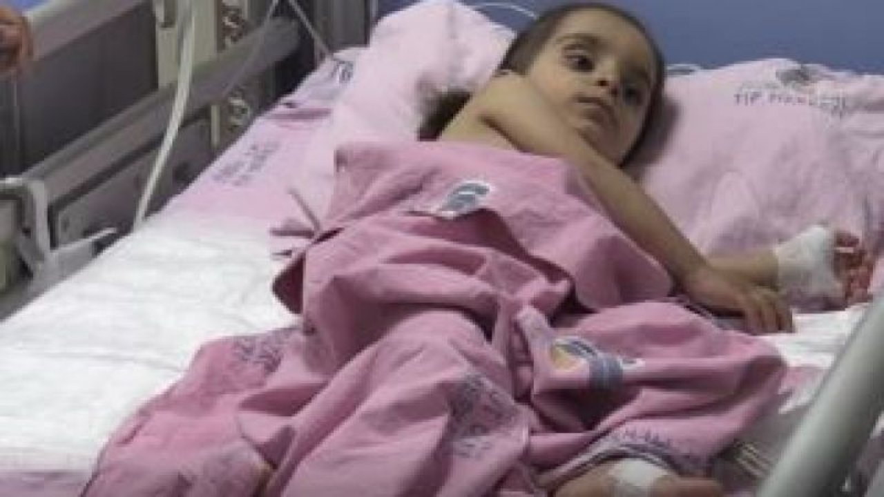 Arı sokması nedeniyle yoğun bakıma alınan 2 yaşındaki Rabia... - Video Haber