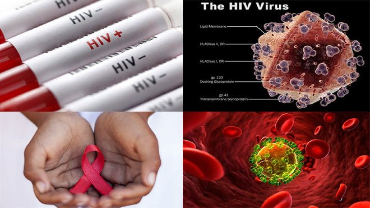 O Ülkede 1,9 milyon kişi HIV (AIDS) virüsü taşıyor!